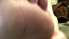 amputee toes
