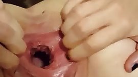 Pom bottle in wide open gaping teen pussy