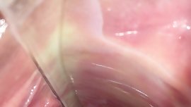 Speculum Inside Views of Amber Wildee From AmberWildee.org !!